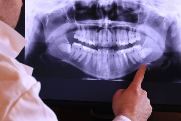 Best Emergency Dentist for Knocked-Out Tooth in Jewett City, CT