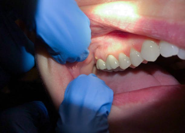 Best Pediatric Emergency Dentist in Jewett City, CT