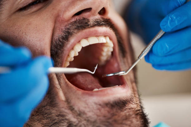 Best Emergency Dentist for Lost Fillings or Crowns in Jewett City, CT